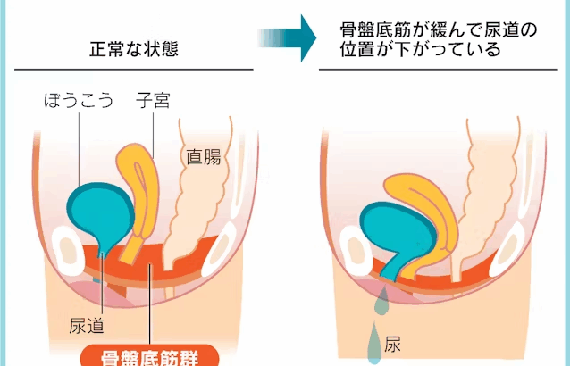 尿漏れ対策？